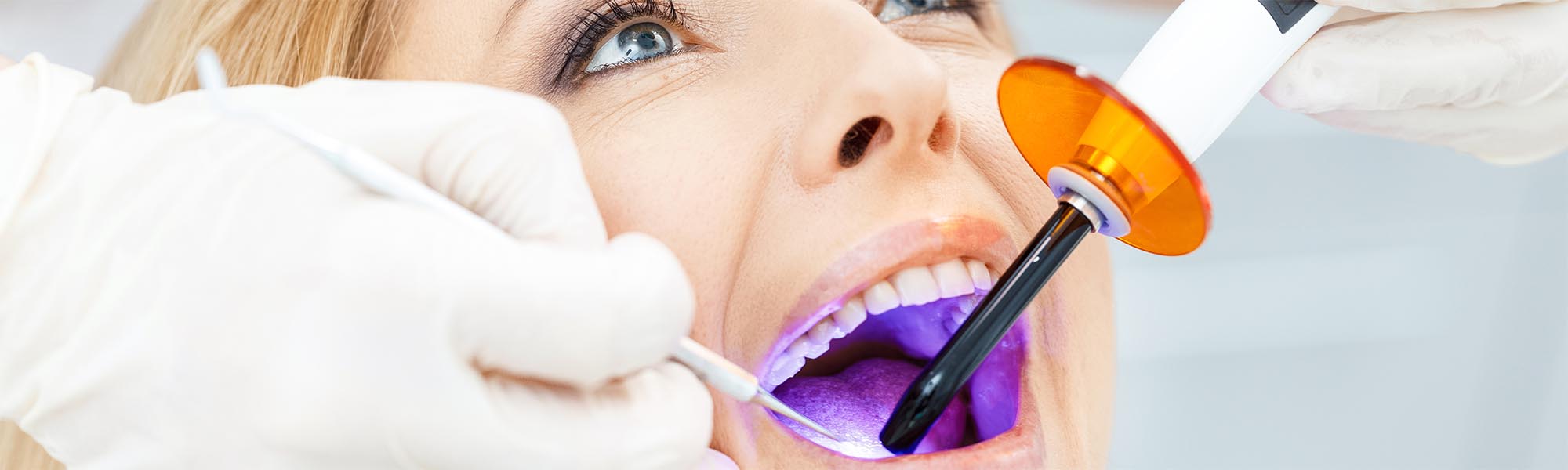 Dental Sealants Carson CA